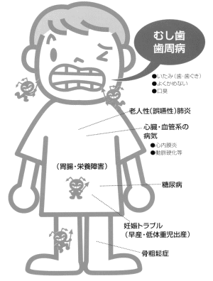 イラスト