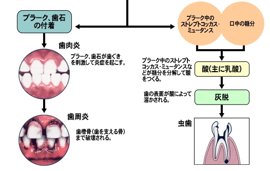 プラークメカニズム