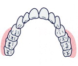 奥歯の表（ほお）側